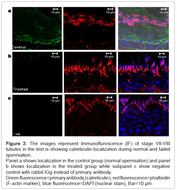analytical-bioanalytical-techniques-Immunofluroscence-tubules-calreticulin