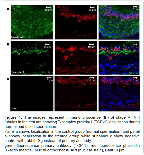 analytical-bioanalytical-techniques-Immunofluroscence-tubules-protein