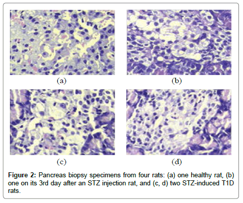 analytical-bioanalytical-techniques-Pancreas-biopsy-specimens