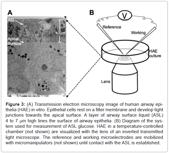 analytical-bioanalytical-techniques-Transmission-electron-microscopy