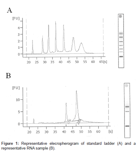 analytical-bioanalytical-techniques-elecropherogram
