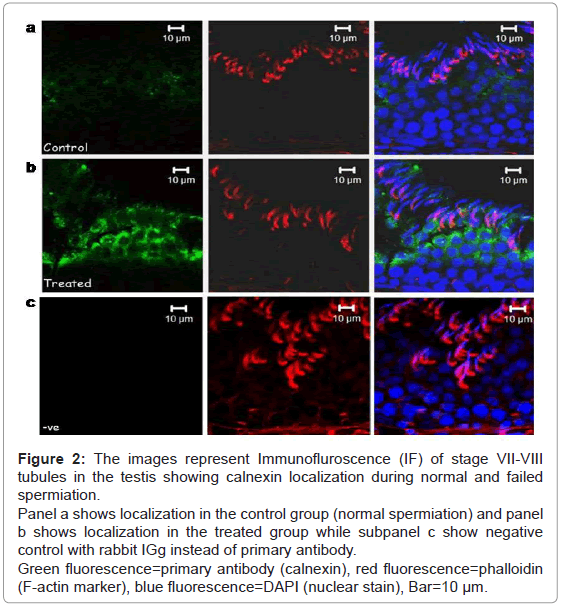 analytical-bioanalytical-techniques-images-Immunofluroscence-tubules