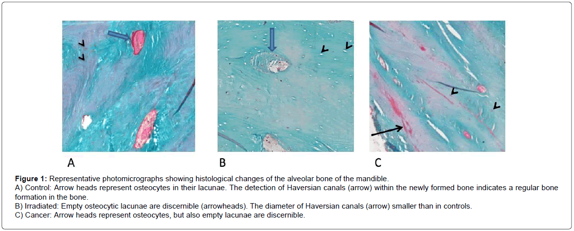 analytical-bioanalytical-techniques-photomicrographs-histological-alveolar