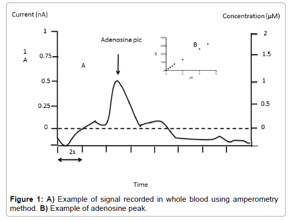analytical-bioanalytical-techniques-signal-recorded