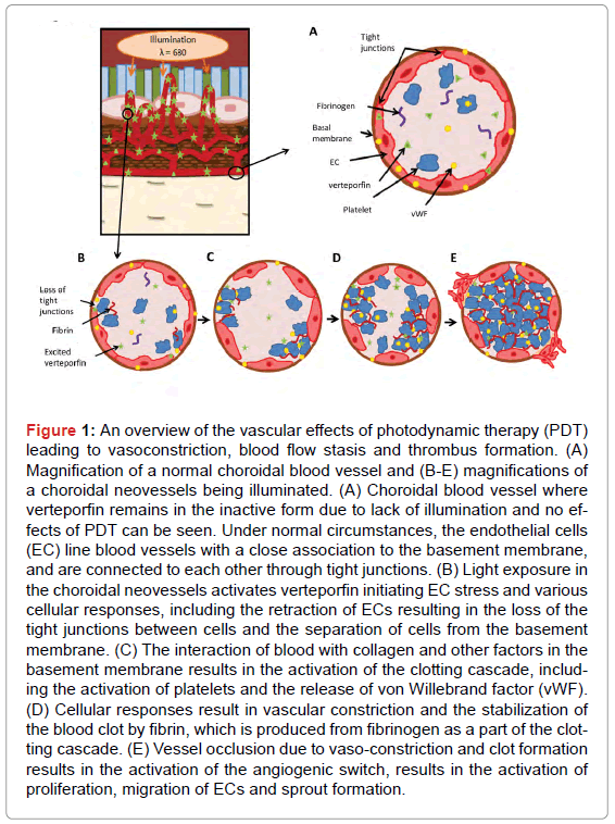 analytical-bioanalytical-techniques-vascular-photodynamic-therapy