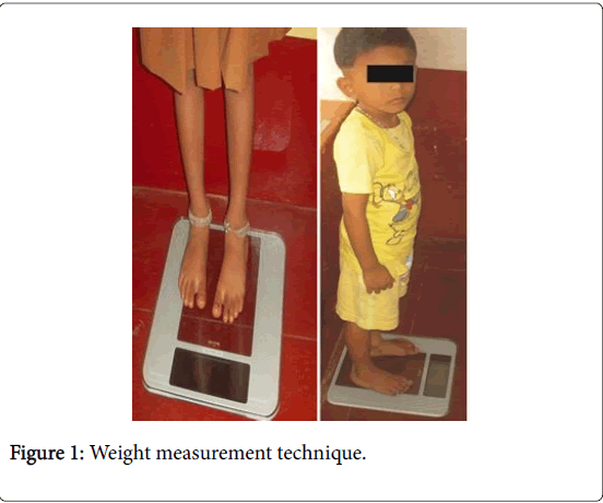 anthropometric measurement of weight for assessment of nutritional weight and measurment