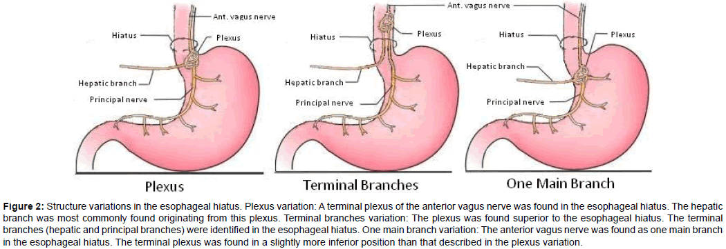 anatomy of the anterior vagus nerve an anatomic description and its