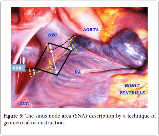 anatomy current event anatomy current event