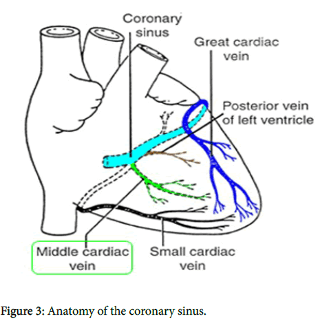 anesthesia-clinical-research-coronary-sinus
