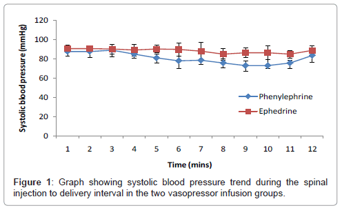 Vasopressor Comparison Chart