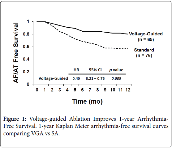 arrhythmia-Voltage-guided