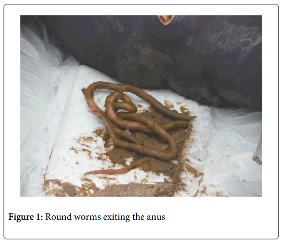 Mass forming around anus tapeworms Sissy slut maid stories