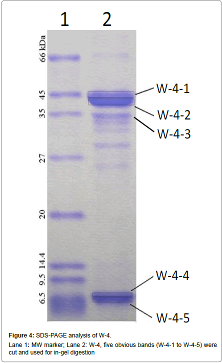 biochemistry-physiology-SDS-PAGE