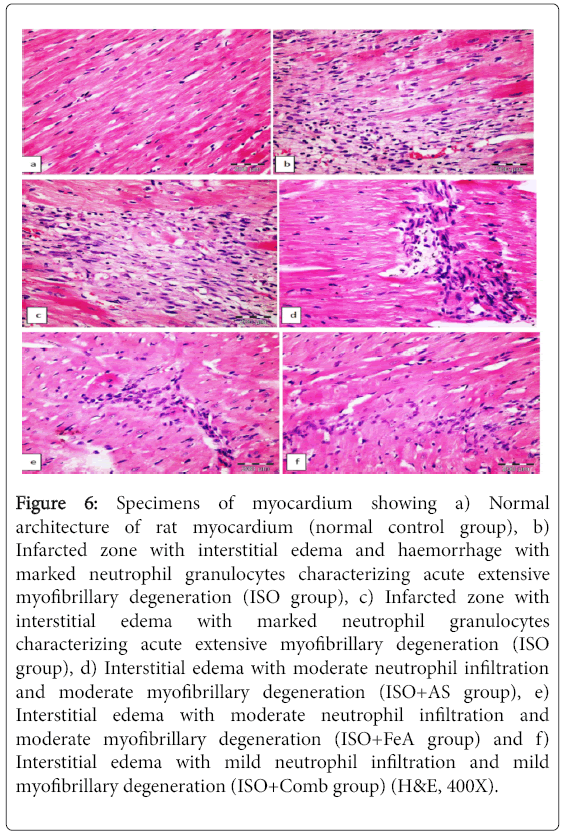 biochemistry-physiology-edema-haemorrhage