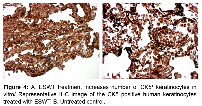 keratinocytes