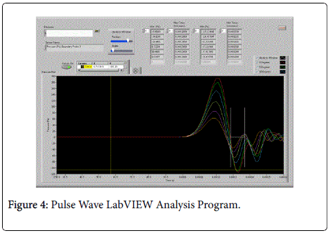 an analysis of the program brass eye Suite of programs for bridge rating and analysis of structural systems known as brass includes the following programs: brass-girder, brass-girder(lrfd) - systems for the analysis and rating. an analysis of the program brass eye Suite of programs for bridge rating and analysis of structural systems known as brass includes the following programs: brass-girder, brass-girder(lrfd) - systems for the analysis and rating.