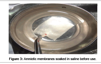 biomimetics-biomaterials-Structure-mniotic-membrane