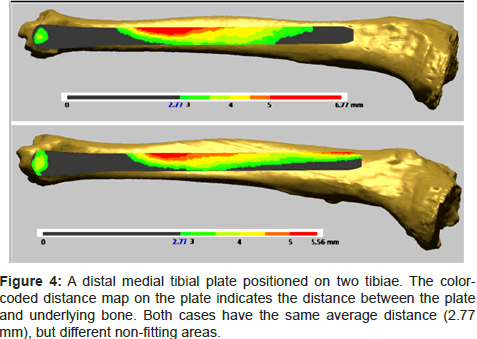 biomimetics-biomaterials-tissue-engineering-tibial-plate-positioned