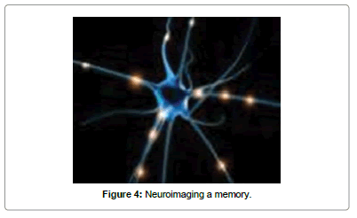 biomusical-engineering-Neuroimaging-memory
