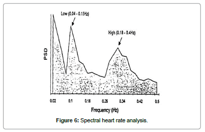 biomusical-engineering-Spectral-heart-rate-analysis