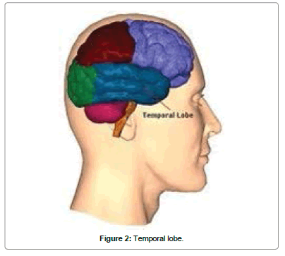 biomusical-engineering-Temporal-lobe