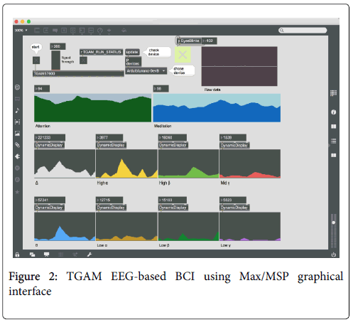 biomusical-engineering-eeg-based-bci