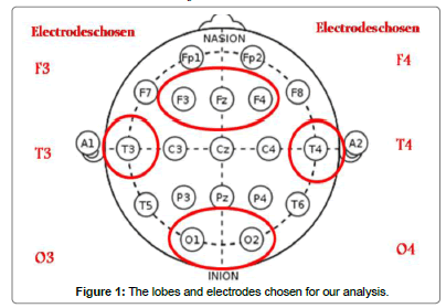 biomusical-engineering-lobes-electrodes-analysis