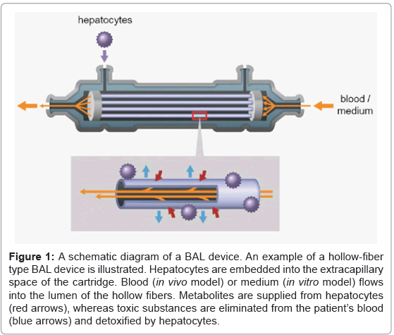 biotechnology-biomaterials-BAL-device