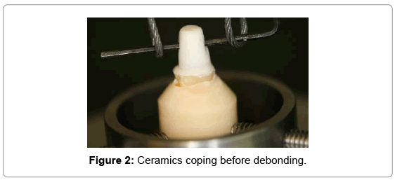biotechnology-biomaterials-Ceramics-coping