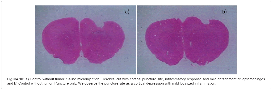 biotechnology-biomaterials-Cerebral-cut