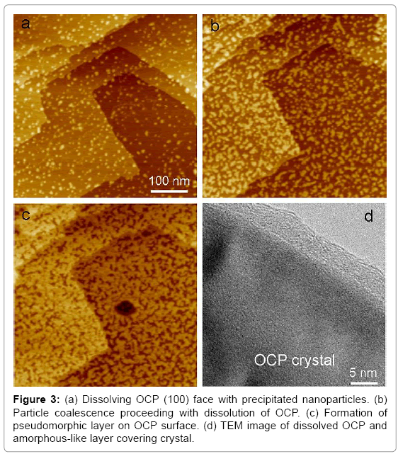 biotechnology-biomaterials-Dissolving-OCP