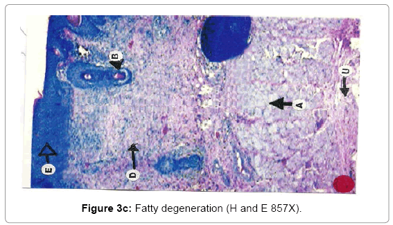 biotechnology-biomaterials-Fatty-degeneration