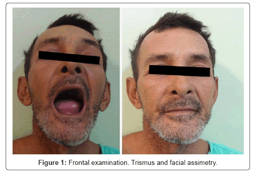 biotechnology-biomaterials-Frontal-examination