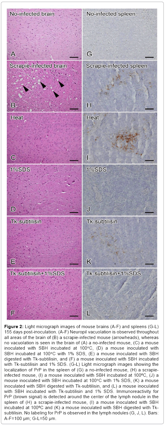 biotechnology-biomaterials-Neuropil-vacuolation