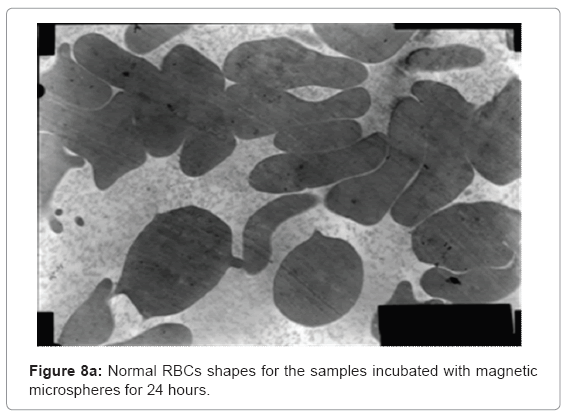 biotechnology-biomaterials-Normal-RBCs