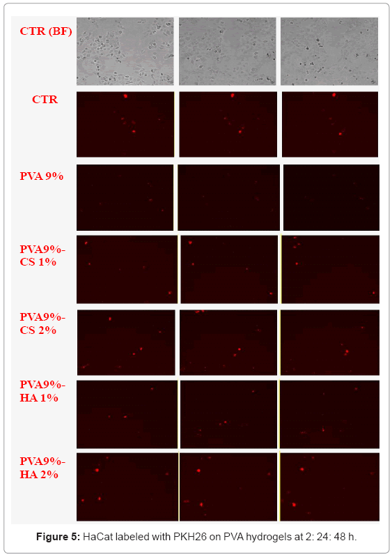 biotechnology-biomaterials-PVA-hydrogels