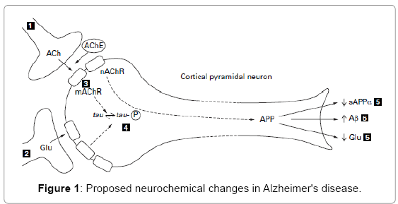 What are the most notable advancements in biotechnology for alzheimer's patients?