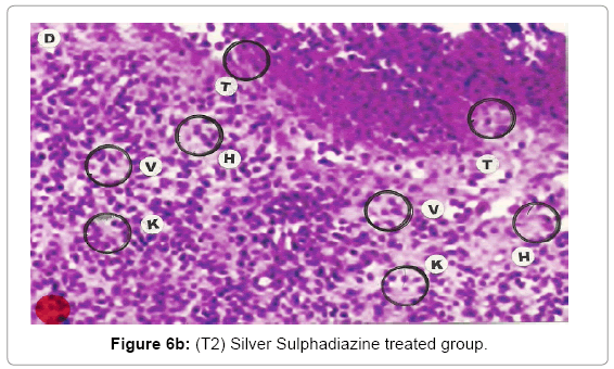 biotechnology-biomaterials-Sulphadiazine