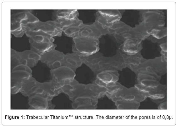 biotechnology-biomaterials-Trabecular-Titanium