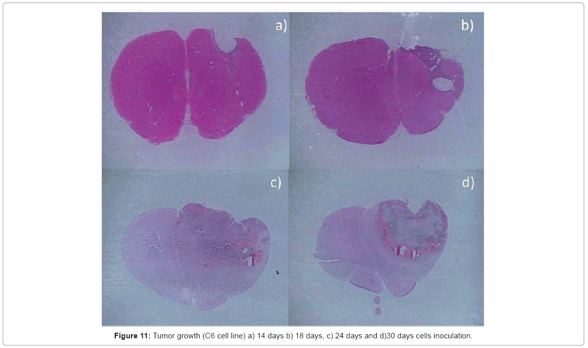 biotechnology-biomaterials-Tumor-growth