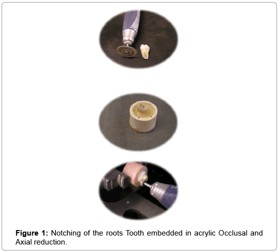 biotechnology-biomaterials-acrylic-Occlusal