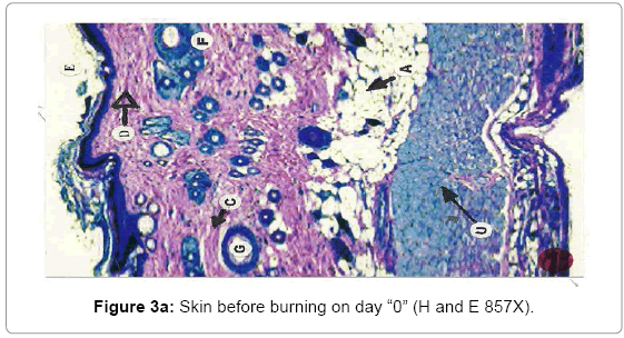 biotechnology-biomaterials-before-burning