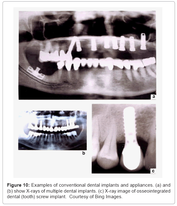 biotechnology-biomaterials-dental-implants