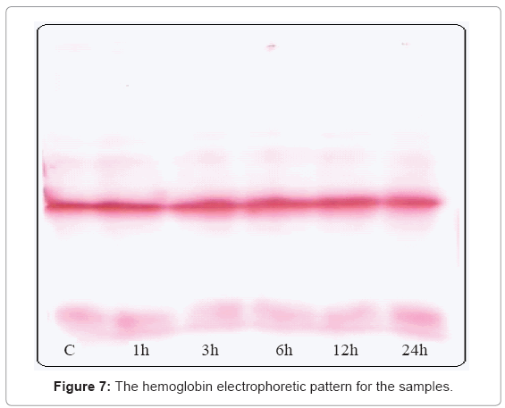 biotechnology-biomaterials-hemoglobin-electrophoretic