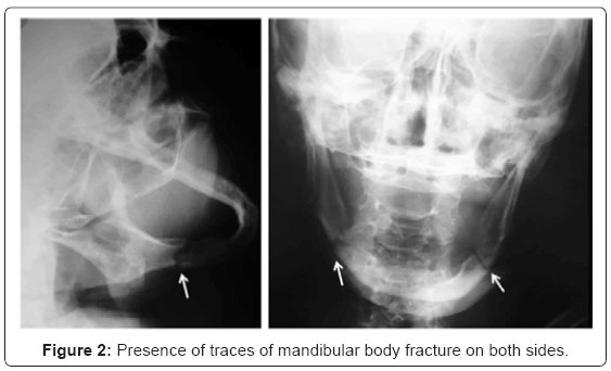 biotechnology-biomaterials-mandibular-body