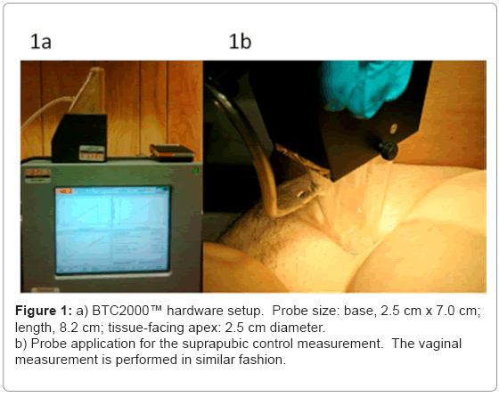biotechnology-biomaterials-suprapubic-control