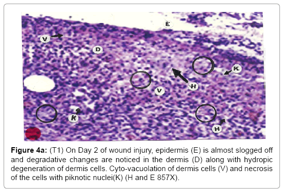 biotechnology-biomaterials-wound-injury