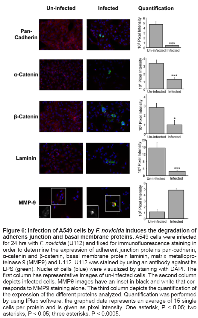 bioterrorism-biodefense-immunofluorescence