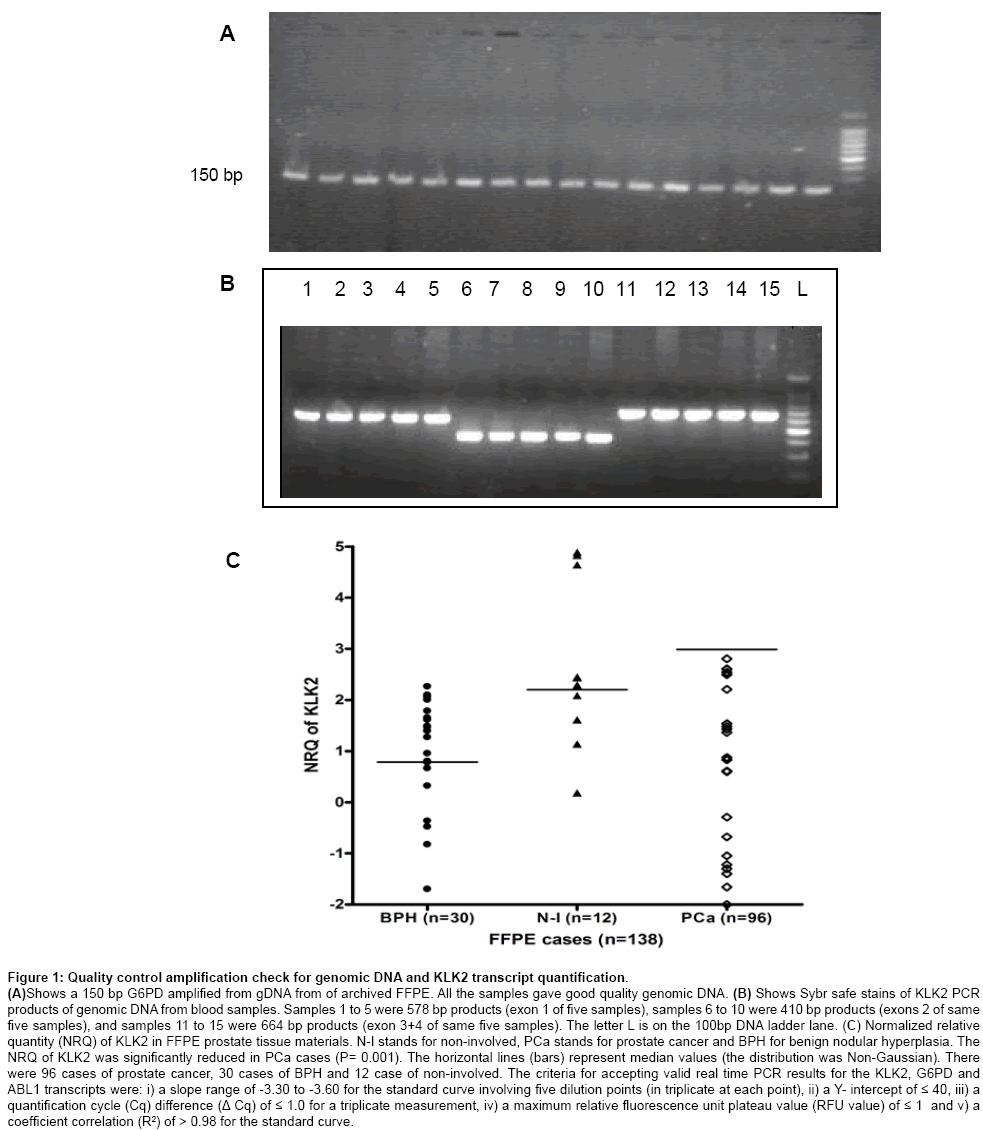 cancer-diagnosis-Quality-control-amplification
