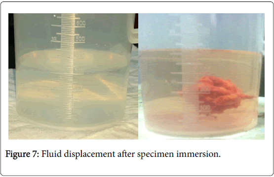 cancer-surgery-Fluid-displacement